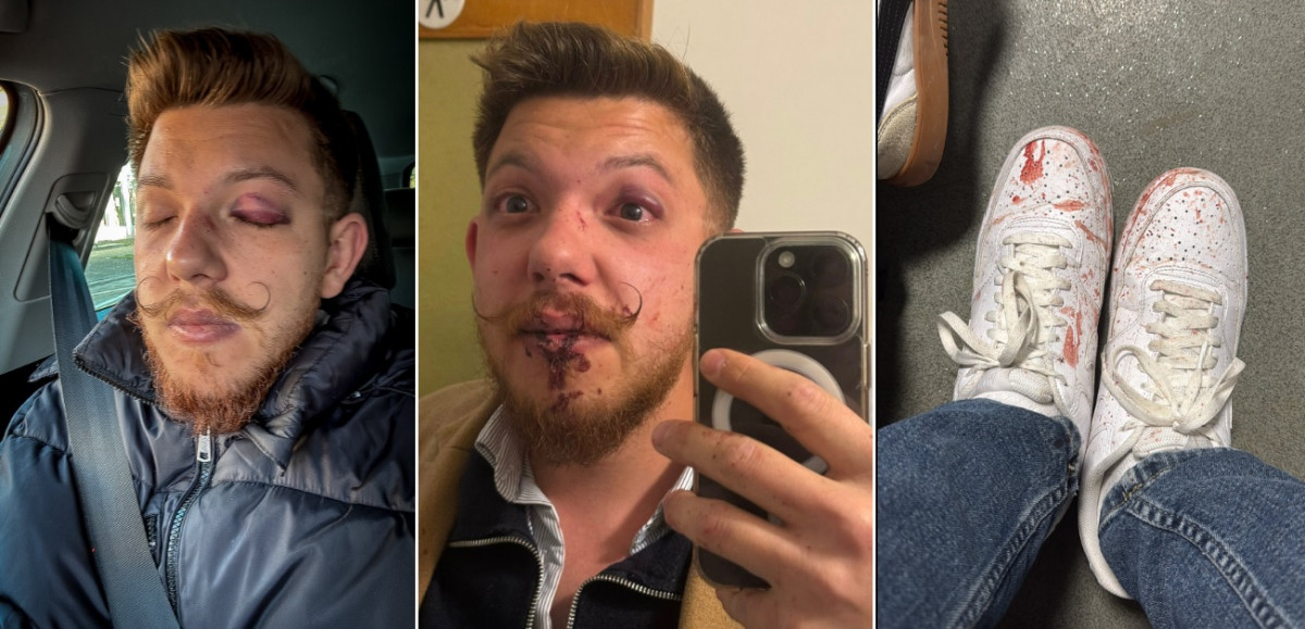 Tiszás szlogent kiabáló fiatalokat vertek össze Sepsiszentgyörgyön