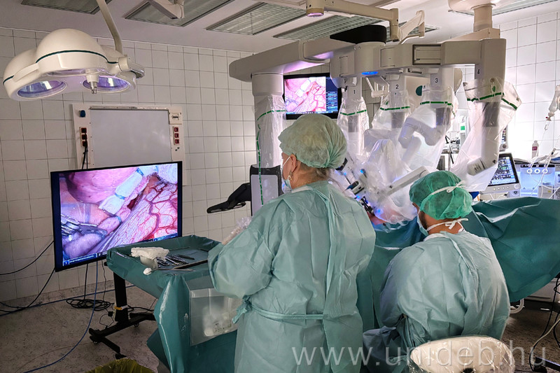 Elkezdődtek a robotasszisztált mellkassebészeti műtétek a debreceni klinikán